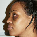 Bilan Mohamud after being attacked in October 2005